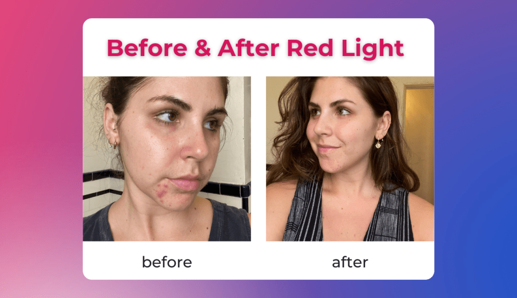 before and after red light therapy
